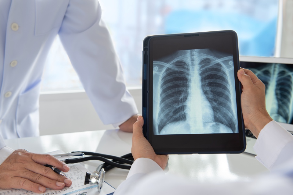Médicos revisan una radiografía torácica